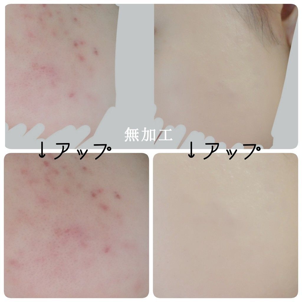 「ザセムコンシーラーの色選びや使い方を徹底解説!ブルベやイエベにおすすめのカラーも紹介♡」の画像(#117919)