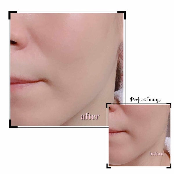 「韓国パックの定番『MEDIHEAL(メディヒール)』人気の種類を効果別に徹底解説!」の画像(#120961)