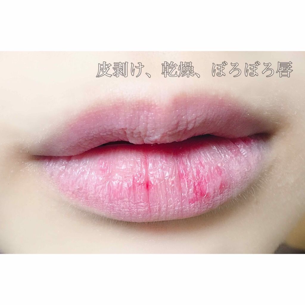 唇の血色を良くする方法 血色感アップにおすすめリップアイテム メイク方法もご紹介 Lips
