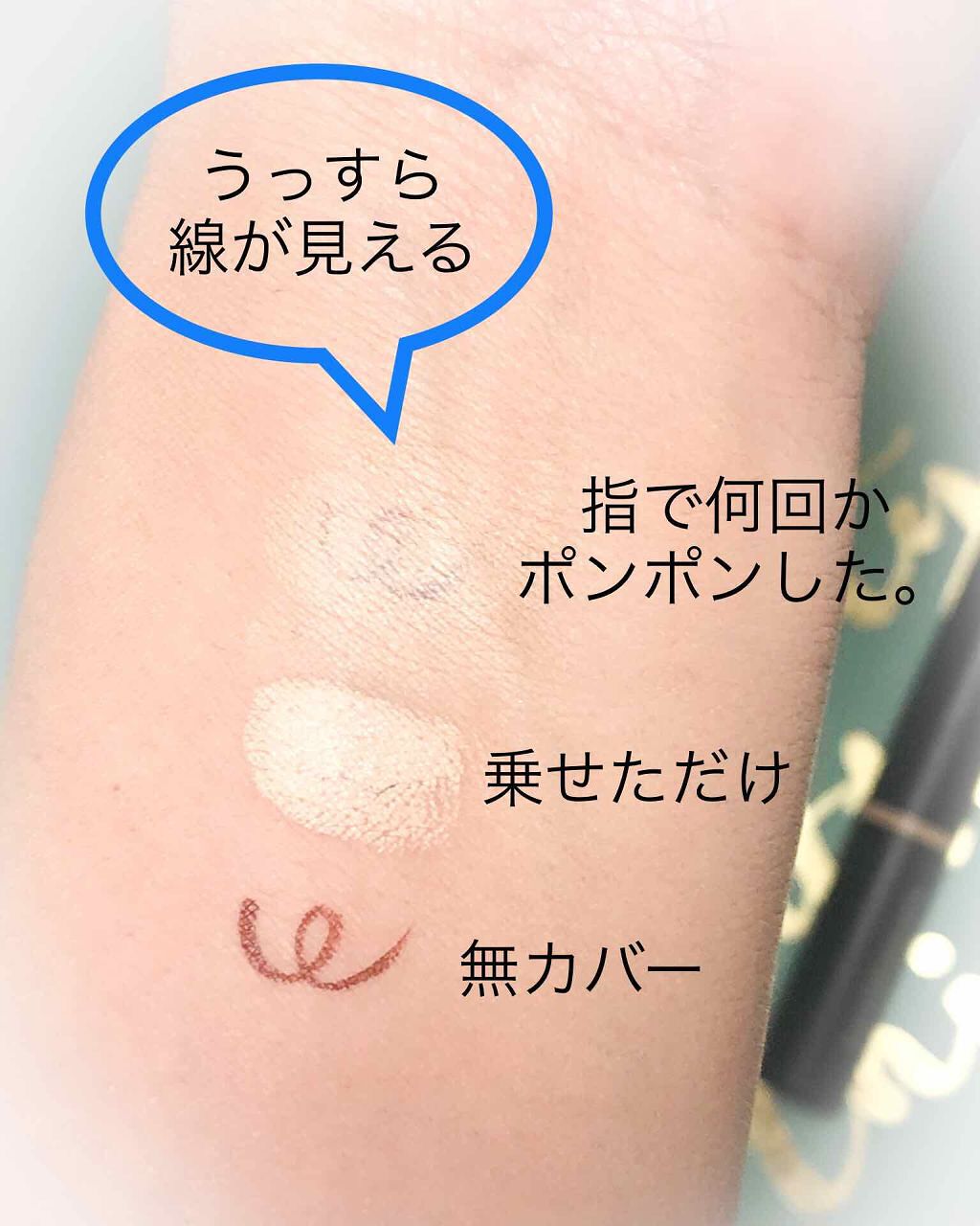 「コンシーラーを使ったシミそばかすの消し方&色選び!消えない・広範囲の悩みも隠すおすすめ人気ランキングTOP11」の画像(#131227)
