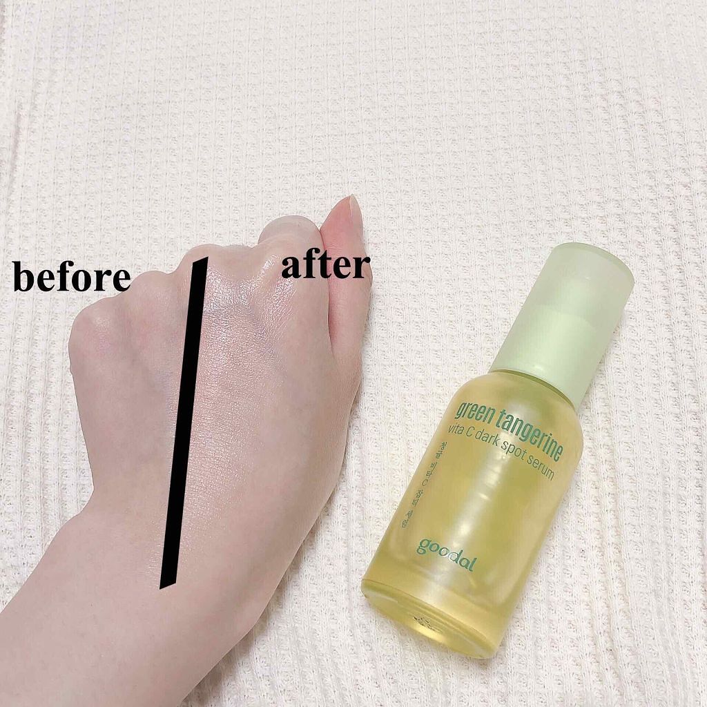 「ビタミンC美容液の効果&使い方は?おすすめアイテム厳選7つもご紹介!」の画像(#134152)