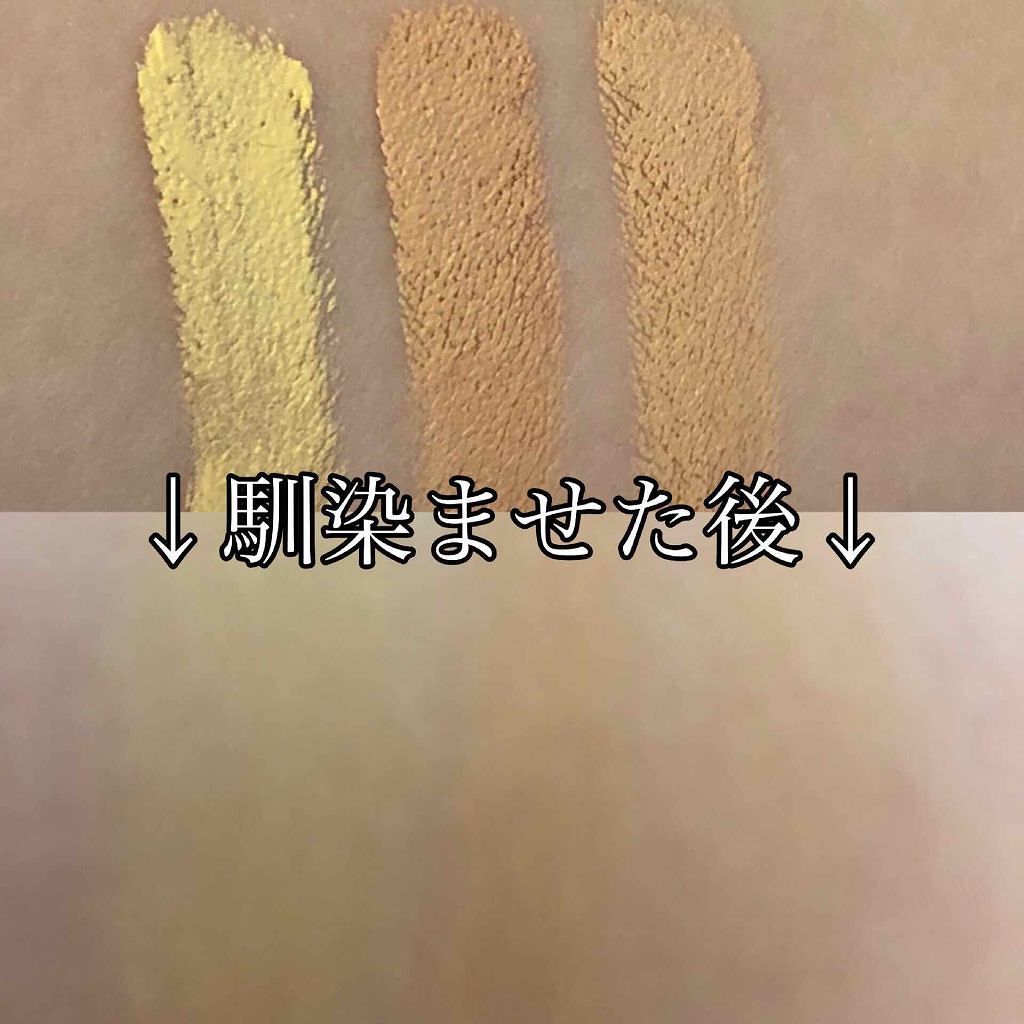 「コンシーラーの使い方!クマ/ニキビ/しみ/そばかす/赤みなど場合別に徹底解説!」の画像(#157169)