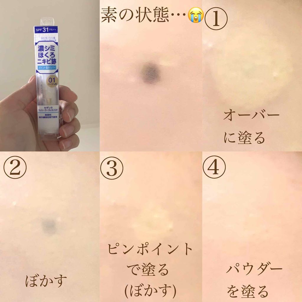 「コンシーラーの使い方!クマ/ニキビ/しみ/そばかす/赤みなど場合別に徹底解説!」の画像(#157184)