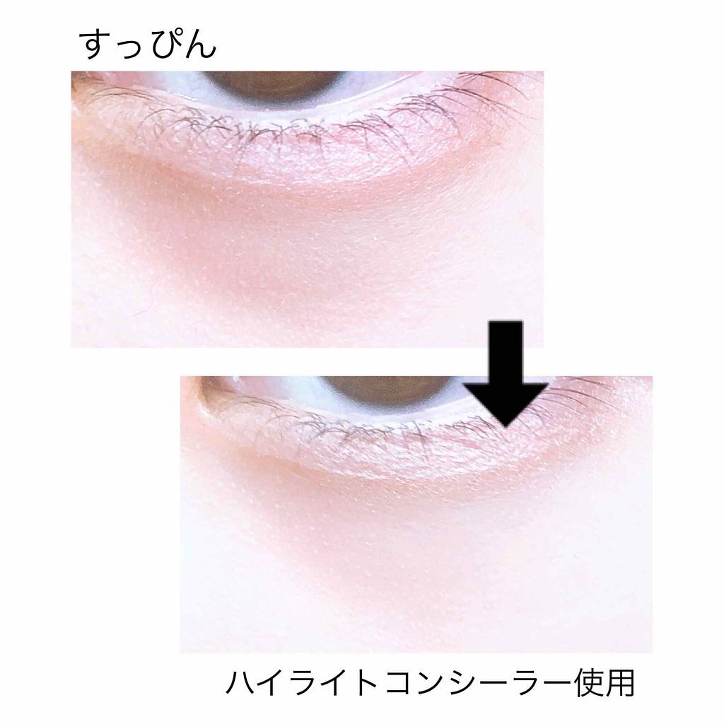 「コンシーラーの使い方!クマ/ニキビ/しみ/そばかす/赤みなど場合別に徹底解説!」の画像(#157208)
