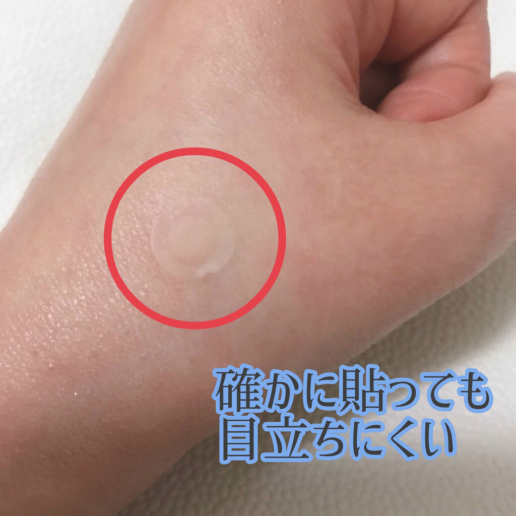 「韓国で人気【ニキビパッチ】おすすめ9選|効果や使い方を画像付きで徹底比較!」の画像(#162272)