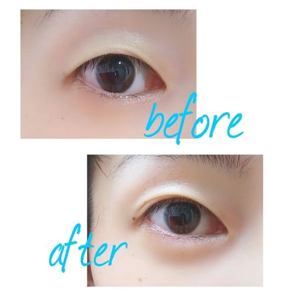 「目元美容液の口コミ人気おすすめ16選|20代~50代別の選び方やアイセラムの効果を高める使い方」の画像(#162987)