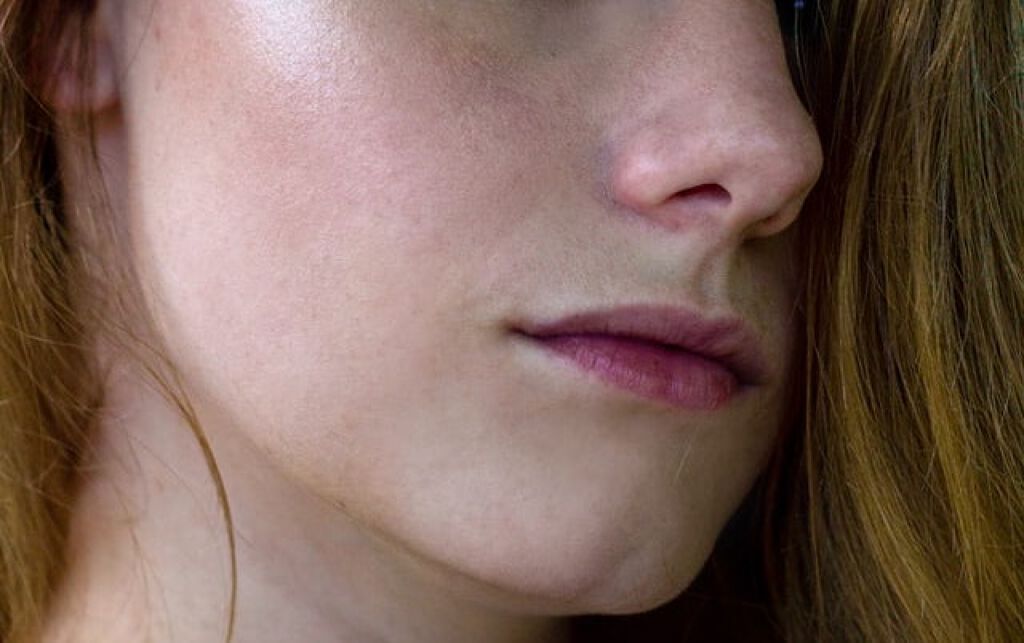 口周りの乾燥、どうする?対策方法4選&おすすめアイテムを解説!の画像