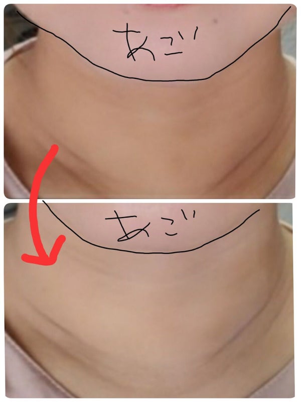 「誰でも簡単!ウユクリームの理想的な使い方を徹底紹介|効果・使う順番も紹介します」の画像(#176192)