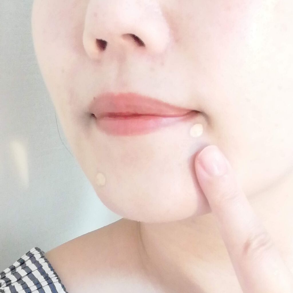 ニキビの隠し方とは?コンシーラー以外のメイク方法や色選びのコツも!の画像