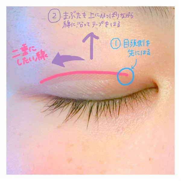 「絆創膏で二重にできない人集合!上手なやり方・剥がし方とおすすめアイメイクを徹底解説」の画像(#187834)