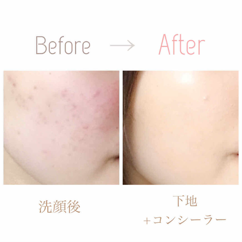 コンシーラーの順番はクッションファンデの後 シミ ニキビ隠しにおすすめの使い方 人気商品14選 Lips