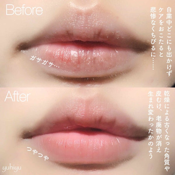 「【ワセリンで唇ケア】おすすめ10選と使い方を解説《塗って寝る・唇パックetc.》【医師監修】」の画像(#191156)