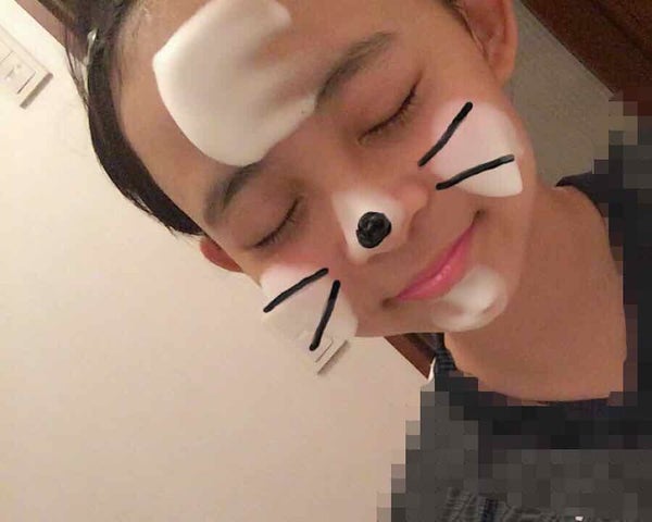 「大人ニキビの予防におすすめの洗顔料16選!原因や洗顔方法なども紹介」の画像(#192482)
