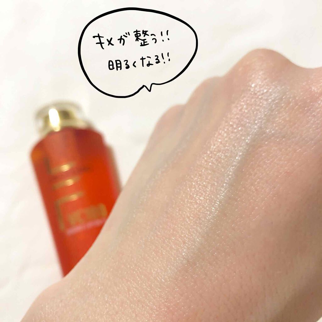 ビタミンc誘導体化粧水おすすめランキング プチプラ デパコス 毛穴やニキビに効果的な使い方と選び方 Lips ビタミンc誘導体化粧水おすすめランキング プチプラ デパコス 毛穴やニキビに効果的な使い方と選び方 Lips