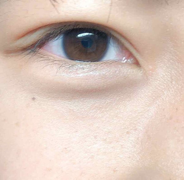 「【話題沸騰】そばかすメイクのやり方!韓国好き必見の「あえて描く」可愛さで魅力UP」の画像(#197077)