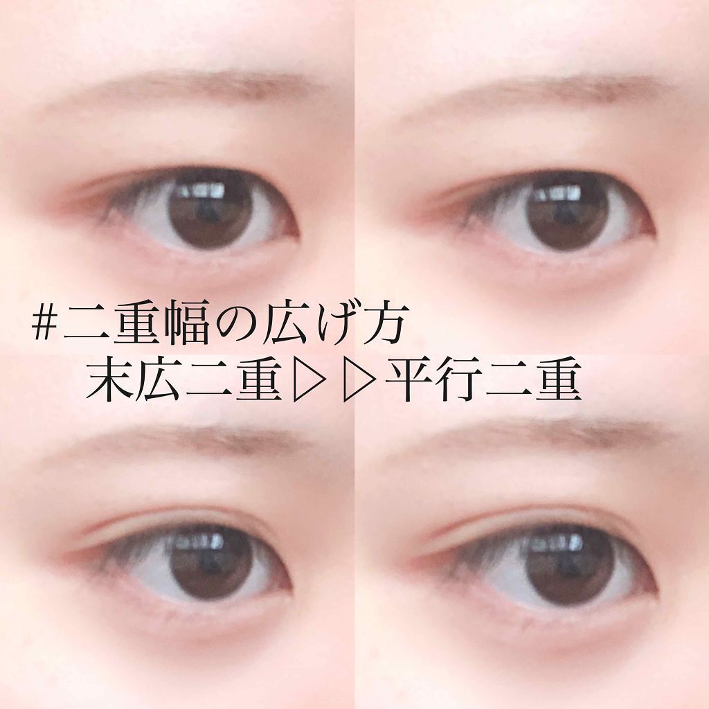 「【整形メイクのやり方】30代・40代も理想の自分に!目・鼻・唇のビフォーアフター&おすすめ人気コスメ12選」の画像(#208240)