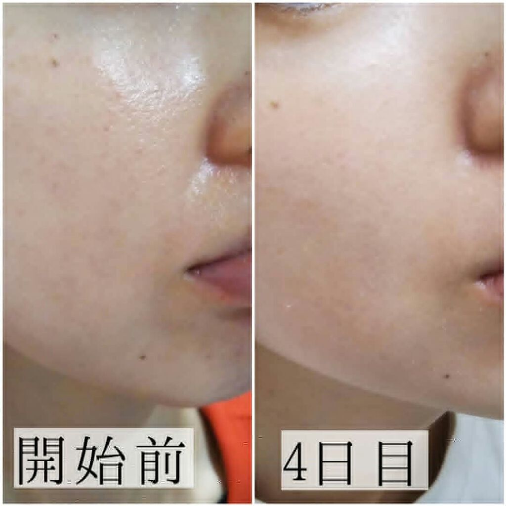 「「洗いすぎない」ベビーオイル洗顔はなぜ話題?正しいやり方や頻度、おすすめオイルをご紹介」の画像(#209771)