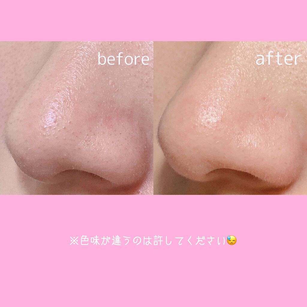 洗いすぎない ベビーオイル洗顔はなぜ話題 正しいやり方や頻度 おすすめオイルをご紹介 Lips
