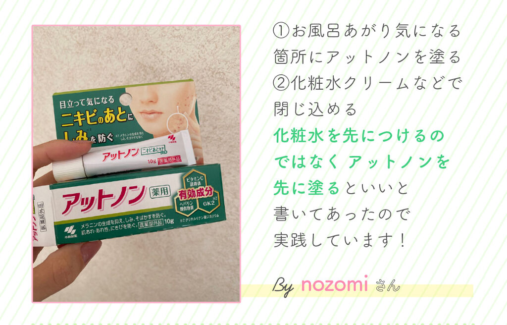 保存版・正しい『ニキビのあと』の肌ケア方法♪の画像