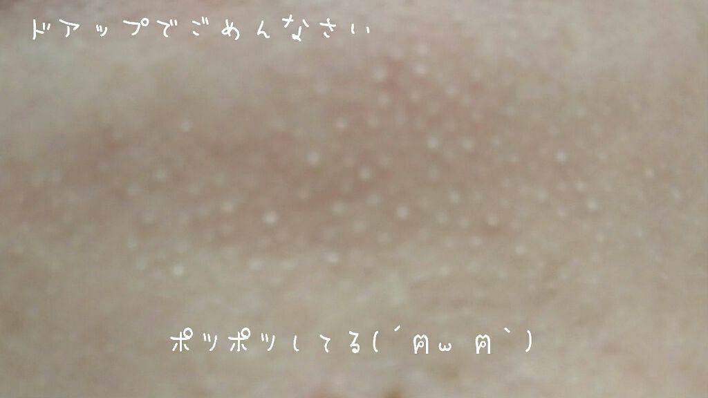 黒ずみ 白いポツポツ 毛穴の汚れを取る 溜めない ケア方法 おすすめアイテム10選 Lips