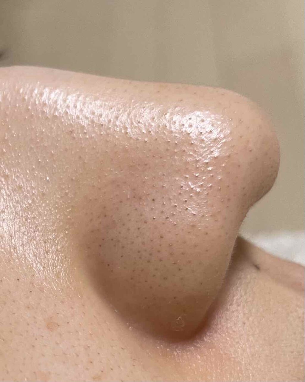 黒ずみ 白いポツポツ 毛穴の汚れを取る 溜めない ケア方法 おすすめアイテム10選 Lips