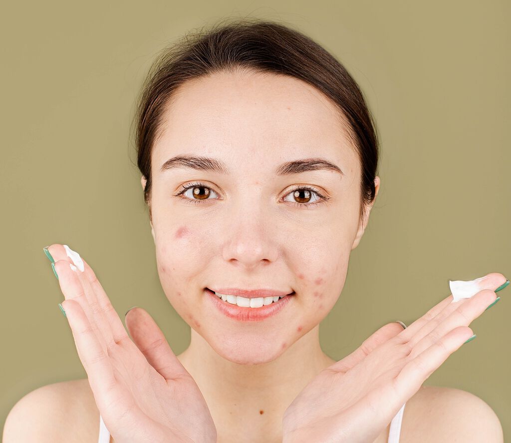 唇のニキビ予防におすすめのスキンケア15選|気になる原因からケア方法までご紹介の画像