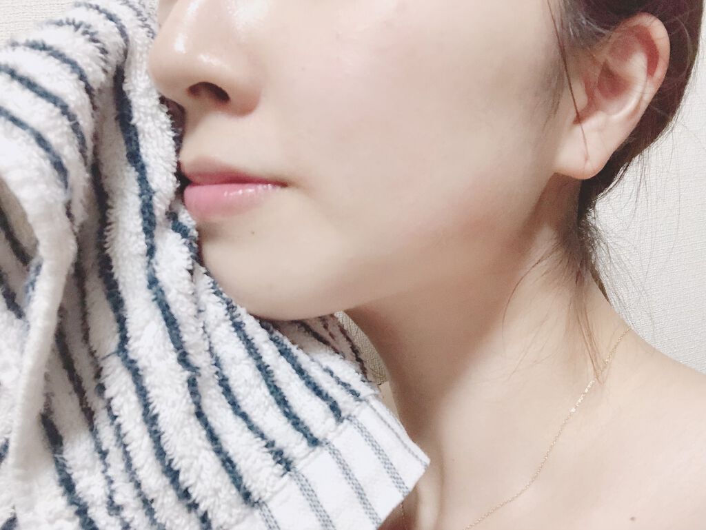 【思春期ニキビ】中高生向け!予防スキンケアと正しい洗顔・保湿方法で跡を残さずに治そうの画像