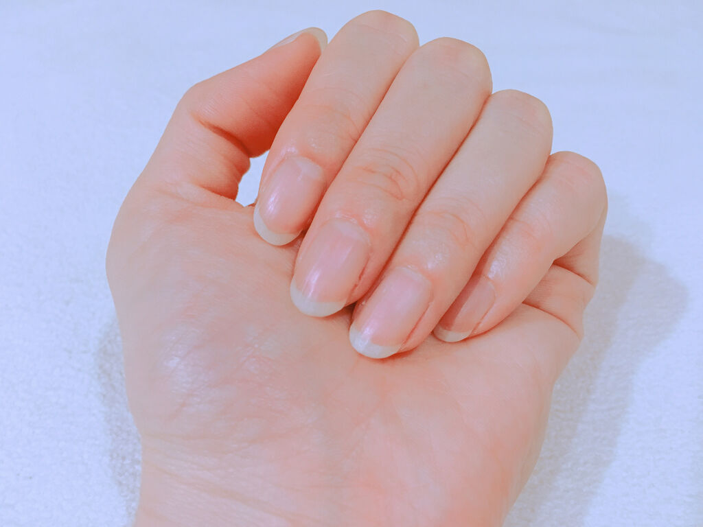 ハイポニキウムはどこ?早く伸ばすコツやおすすめオイルを紹介!伸びないときの対処法もの画像