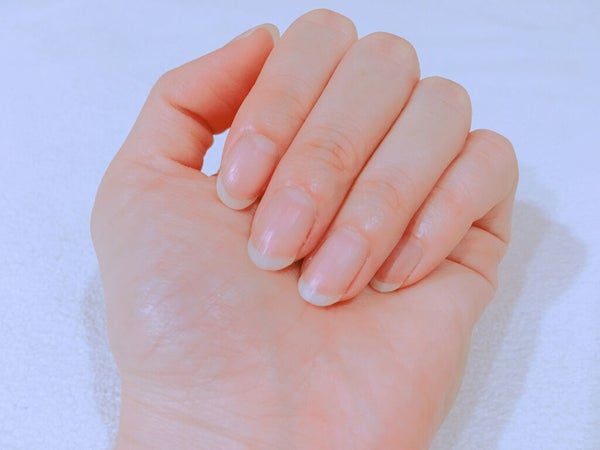 ハイポニキウムはどこ?早く伸ばすコツやおすすめオイルを紹介!伸びないときの対処法もの画像