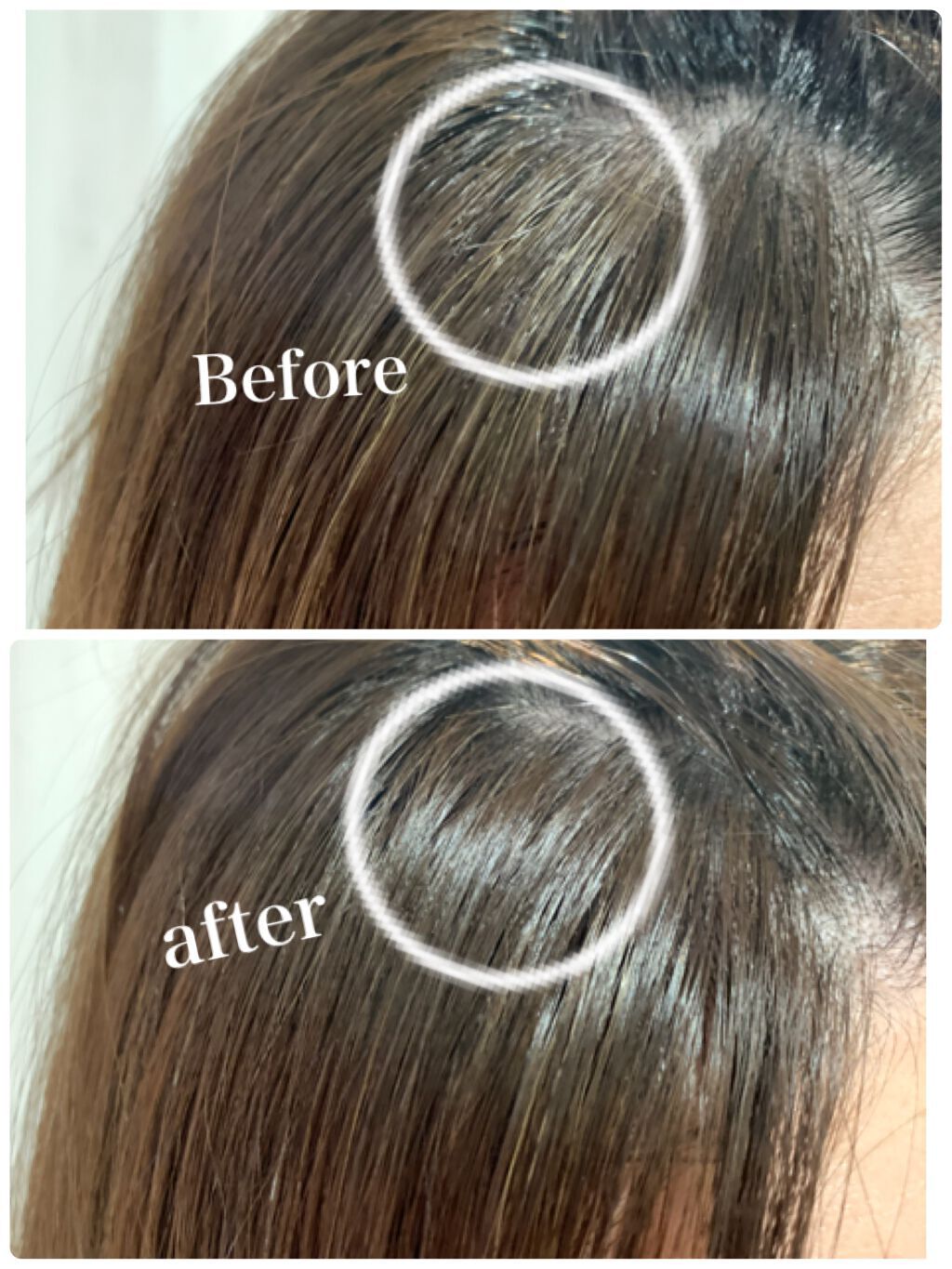 「【ヘアカラーと白髪染め】の違いとは?女性むけ市販カラー剤の選び方とおすすめ10選」の画像(#294478)