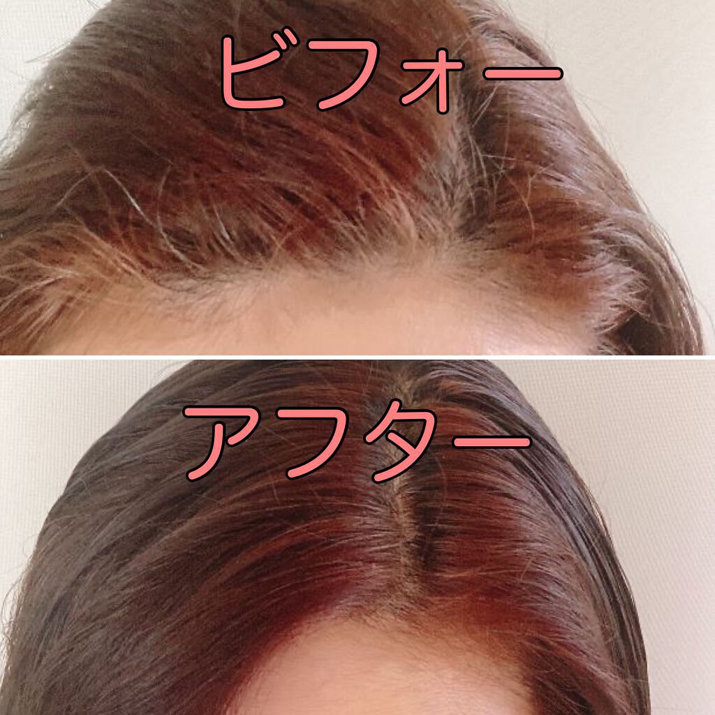 「【ヘアカラーと白髪染め】の違いとは?女性むけ市販カラー剤の選び方とおすすめ10選」の画像(#294479)