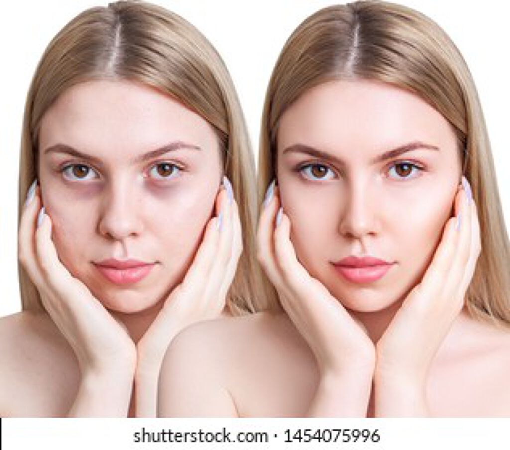 目の下のくまを何とかしたい!【原因別の改善方法やきれいにカバーできる優秀アイテムも】の画像