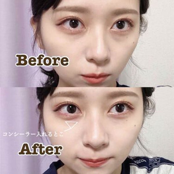 目の下のくまを何とかしたい!【原因別の改善方法やきれいにカバーできる優秀アイテムも】の画像