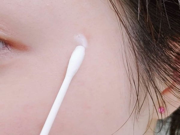 「シミ予防におすすめのクリーム7選【プチプラ・デパコス】早めのスキンケアで予防しよう」の画像(#303632)