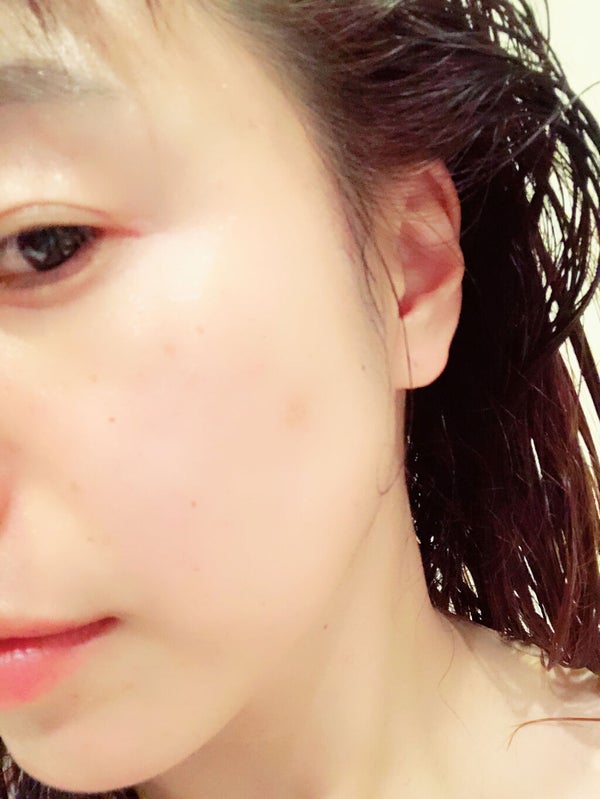 シミ予防におすすめのクリーム7選【プチプラ・デパコス】早めのスキンケアで予防しようの画像