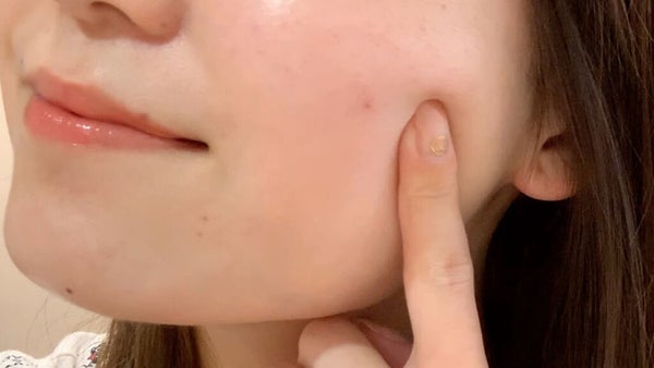 シミ予防におすすめのクリーム7選【プチプラ・デパコス】早めのスキンケアで予防しようの画像