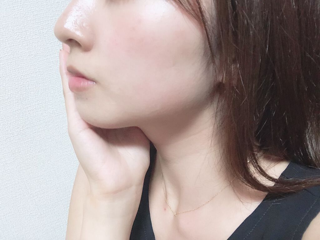 ワセリンを顔に塗っても大丈夫?効果や正しい使い方・ニキビや毛穴への注意点も解説の画像