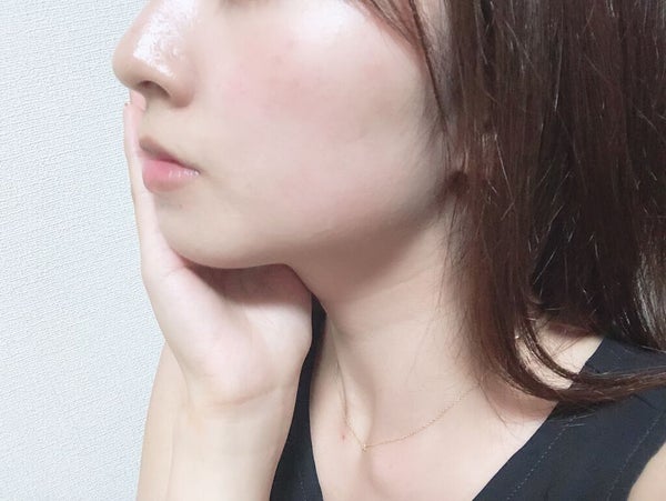 ワセリンを顔に塗っても大丈夫?効果や正しい使い方・ニキビや毛穴への注意点も解説の画像