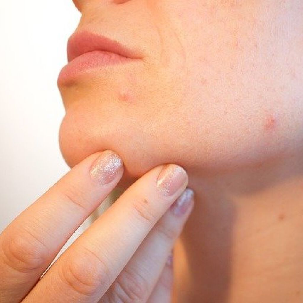 大人ニキビ予防のクレンジングおすすめ15選【ドラッグストア・プチプラ・デパコス】口コミもご紹介!の画像