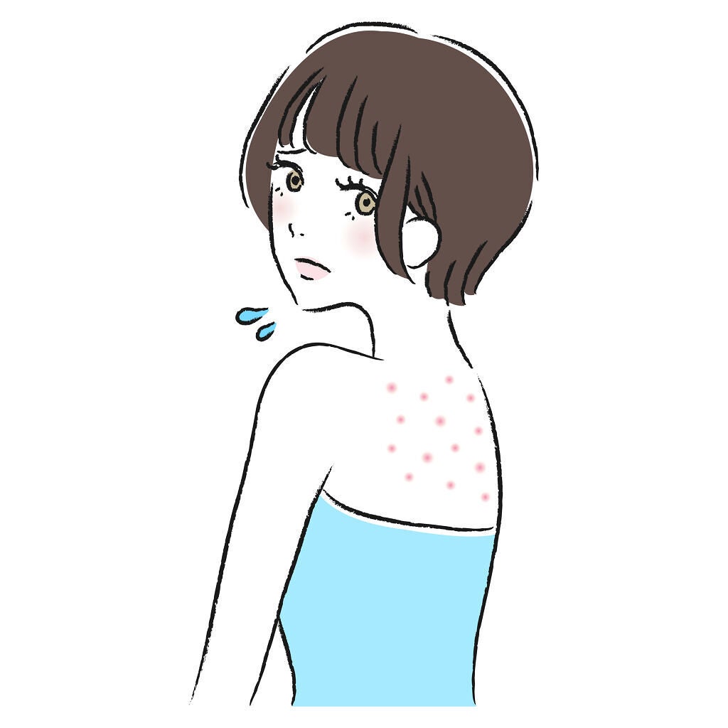 体の毛穴トラブルのケア方法は?詰まりや黒ずみ・ブツブツの原因とおすすめアイテム12選の画像