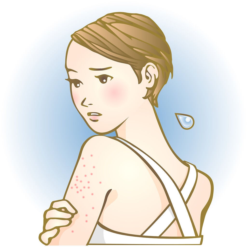 体の毛穴トラブルのケア方法は?詰まりや黒ずみ・ブツブツの原因とおすすめアイテム12選の画像