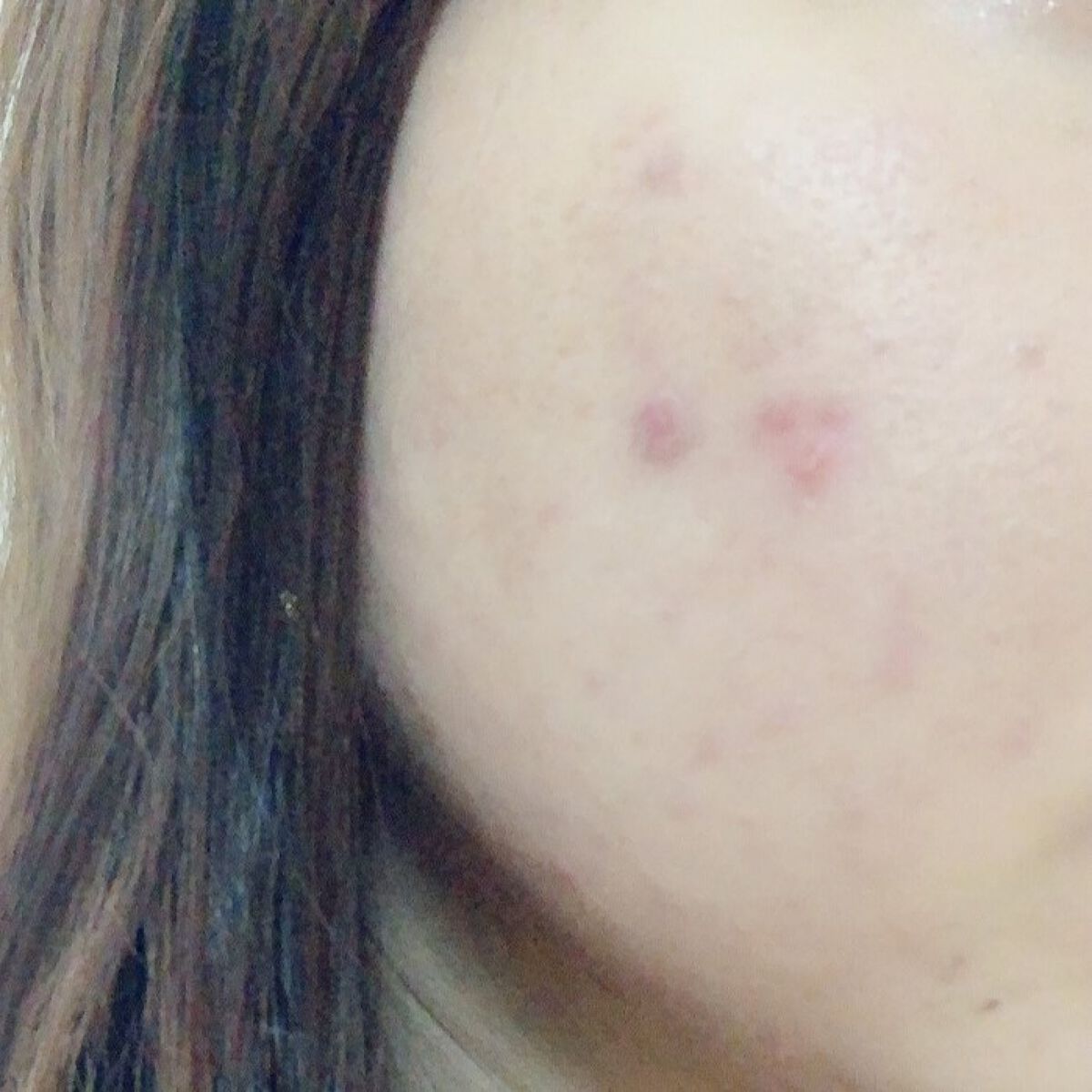 【コンシーラーのタイプ・種類】おすすめの使い分け方を解説!《リキッド・パレット・ペンシルetc,》の画像