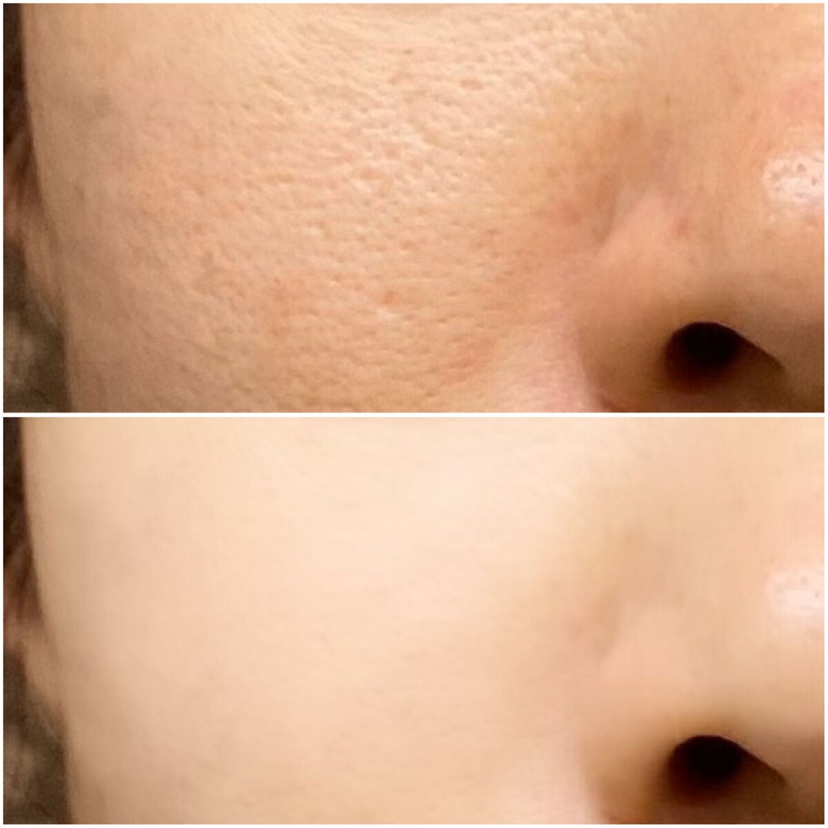 【アラフォーの毛穴ケア】たるみや開き毛穴、いちご鼻の改善方法《プチプラのおすすめアイテムも!》の画像