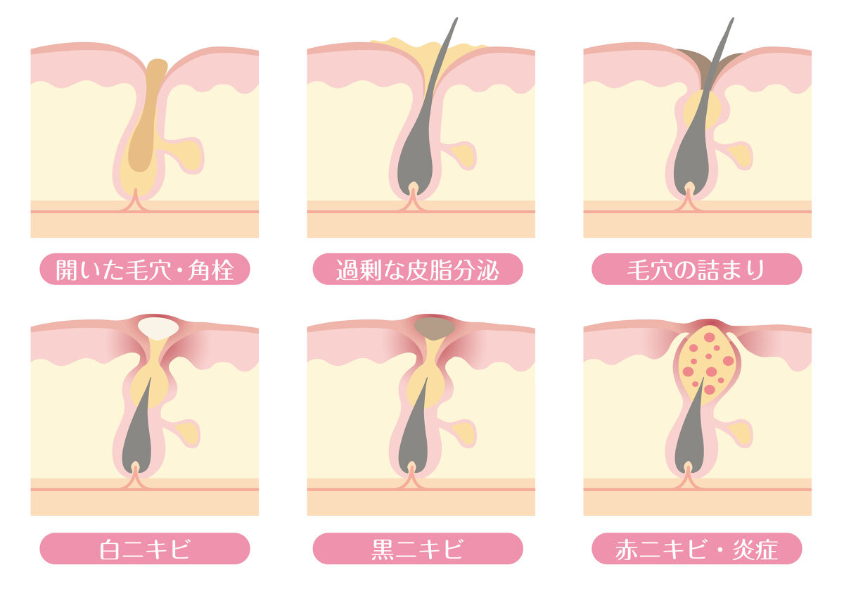 毛穴クレンジングおすすめ23選【口コミで人気】毛穴の黒ずみ・開き・詰まりをケア!の画像