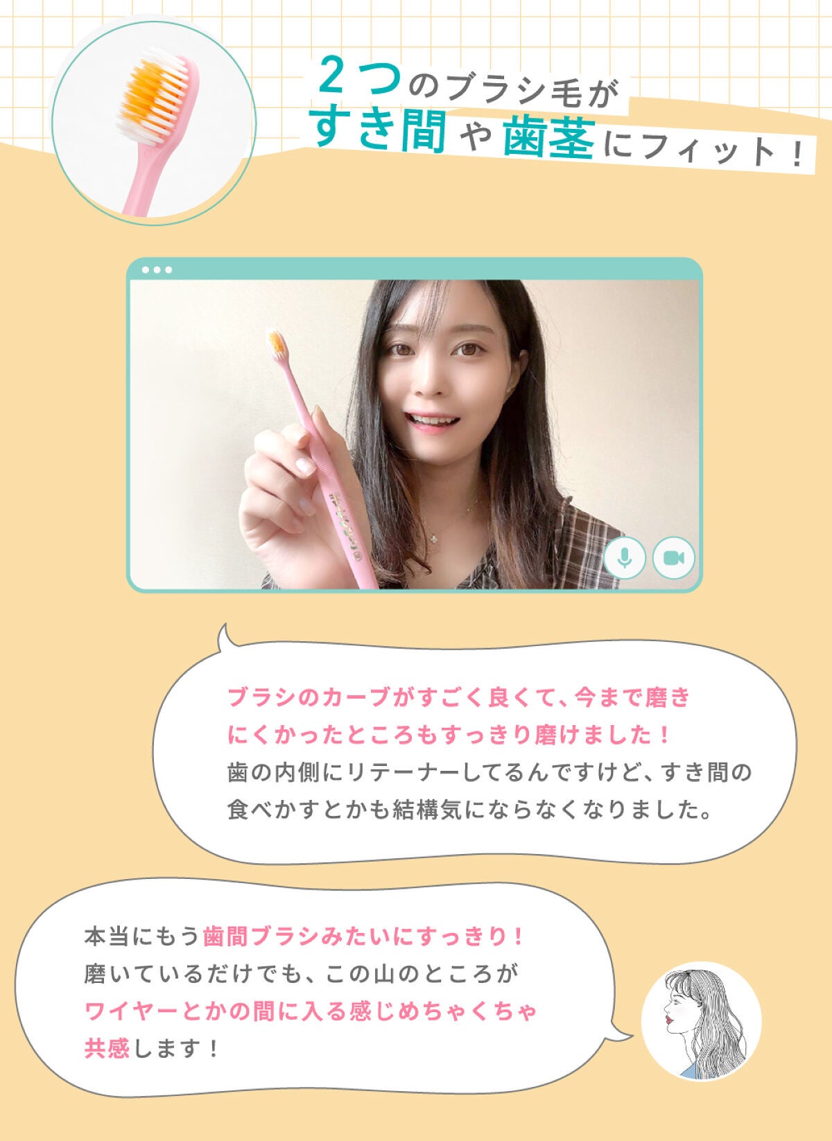 歯列矯正中のあるあるが止まらない!ユーザー激推し!簡単&快適なお手入れアイテムもご紹介の画像