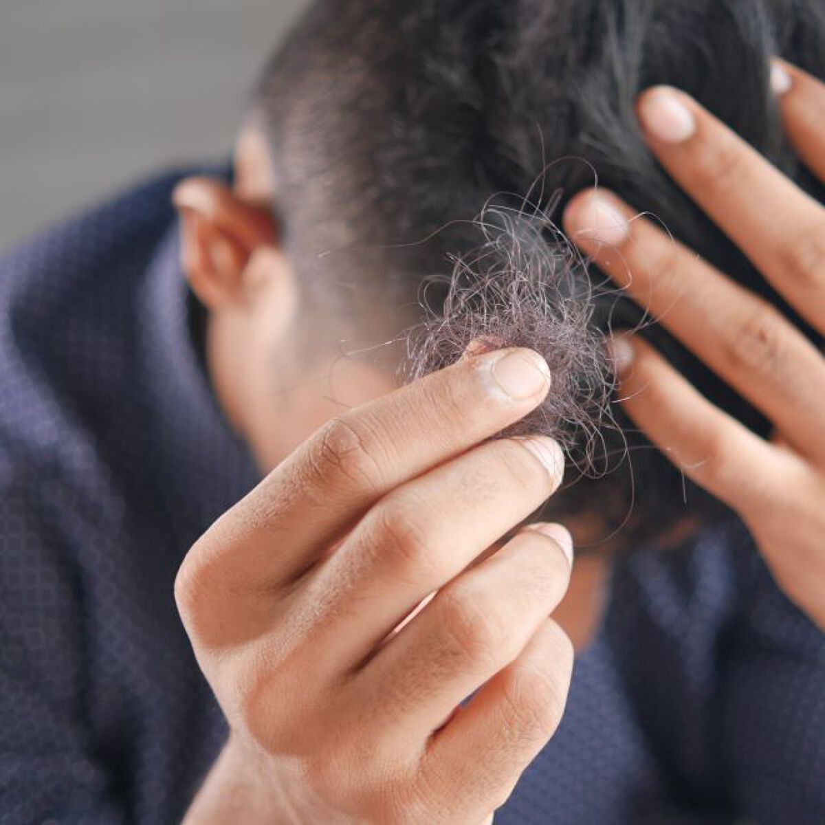 メンズの頭皮ケアにおすすめアイテム16選。シャンプー・トリートメント・トニックの選び方やスカルプケアのやり方も解説の画像