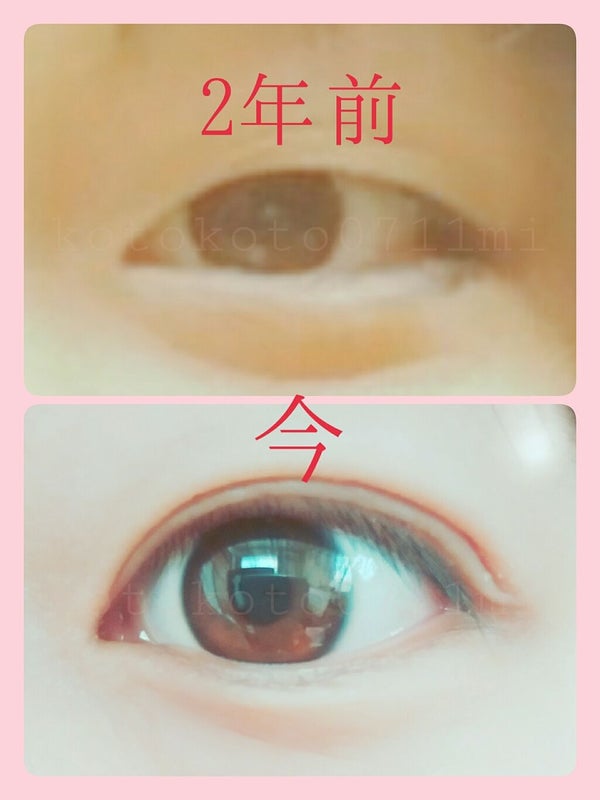 「パッチリ二重をメイクで作ろう!LIPSで人気の二重グッズを一挙紹介♪」の画像(#64314)