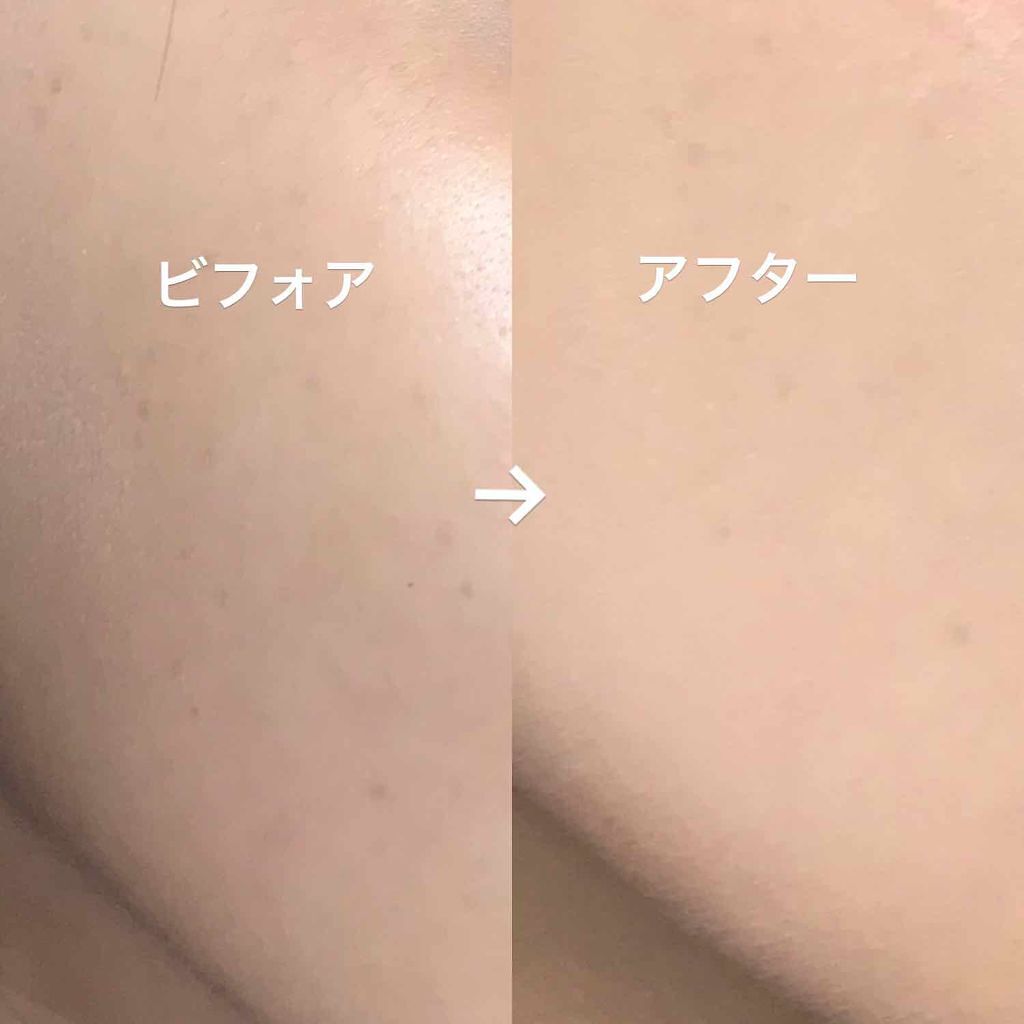 「しっとりツヤ肌仕上げ♡秋冬にぴったりなソリッドファンデーション特集!」の画像(#65305)