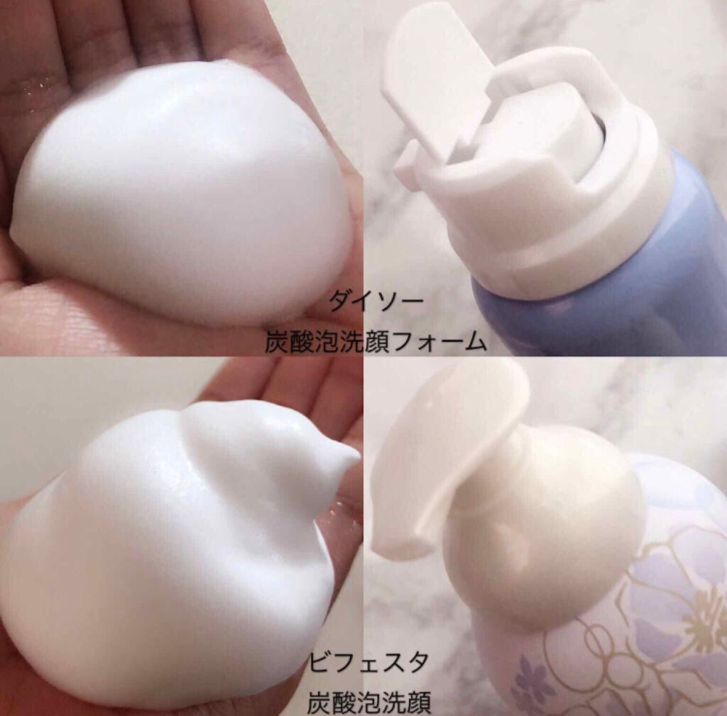 「しゅわパチ感がクセになる♡炭酸スキンケア、こんなに種類があるの知ってた?」の画像(#90813)