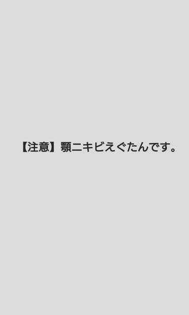 お久しぶり

ここ最近ROM専になってて全くといっていいほどクチコミ書いてなかったことに気づいた
てなわけで最近使い切ったロゼッタのアクネクリアを評価する

ぶっちゃけいうとニキビは減らねえ、使い心地が